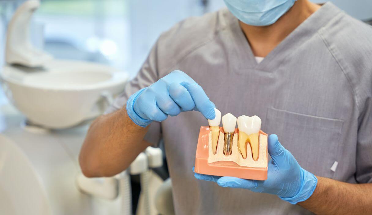 Am I a Candidate for Dental Implants in Somerset, NJ
