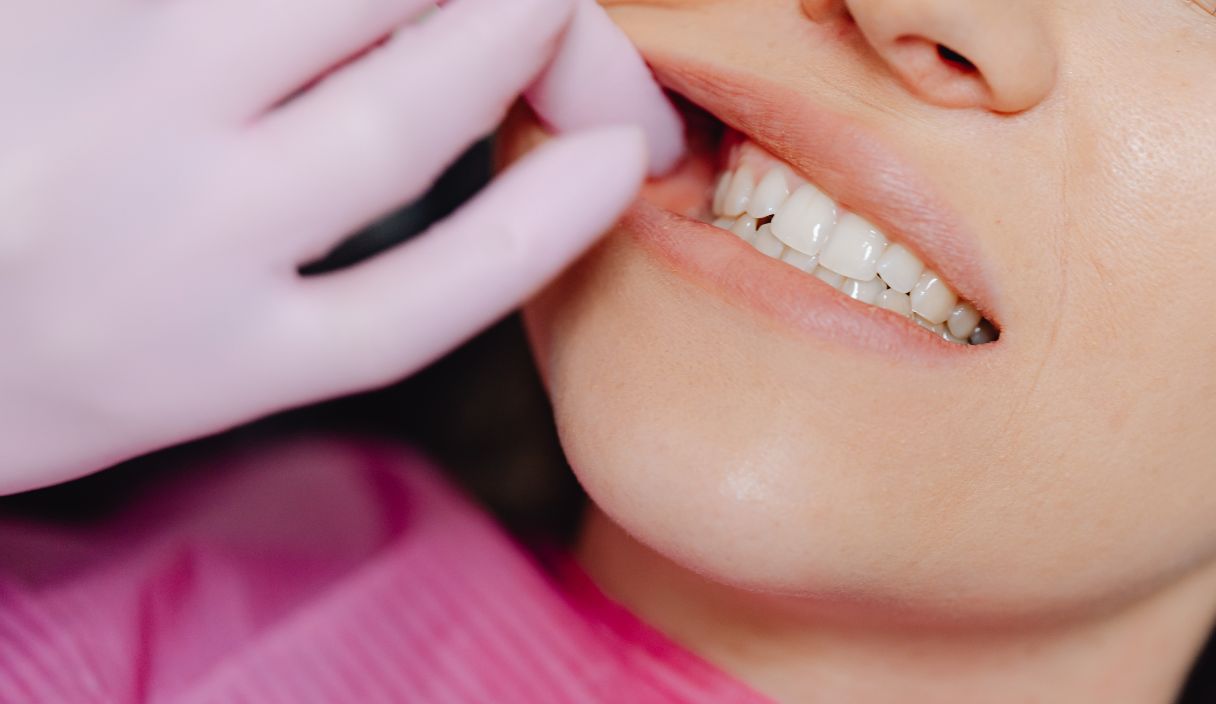 Gum Disease Stages, Symptoms