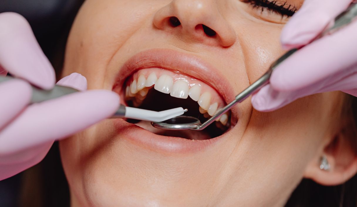 dentist-near-hillsborough-nj-
